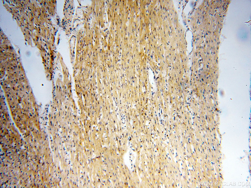 Immunohistochemistry (IHC) staining of human heart tissue using PCSK5 Polyclonal antibody (16470-1-AP)