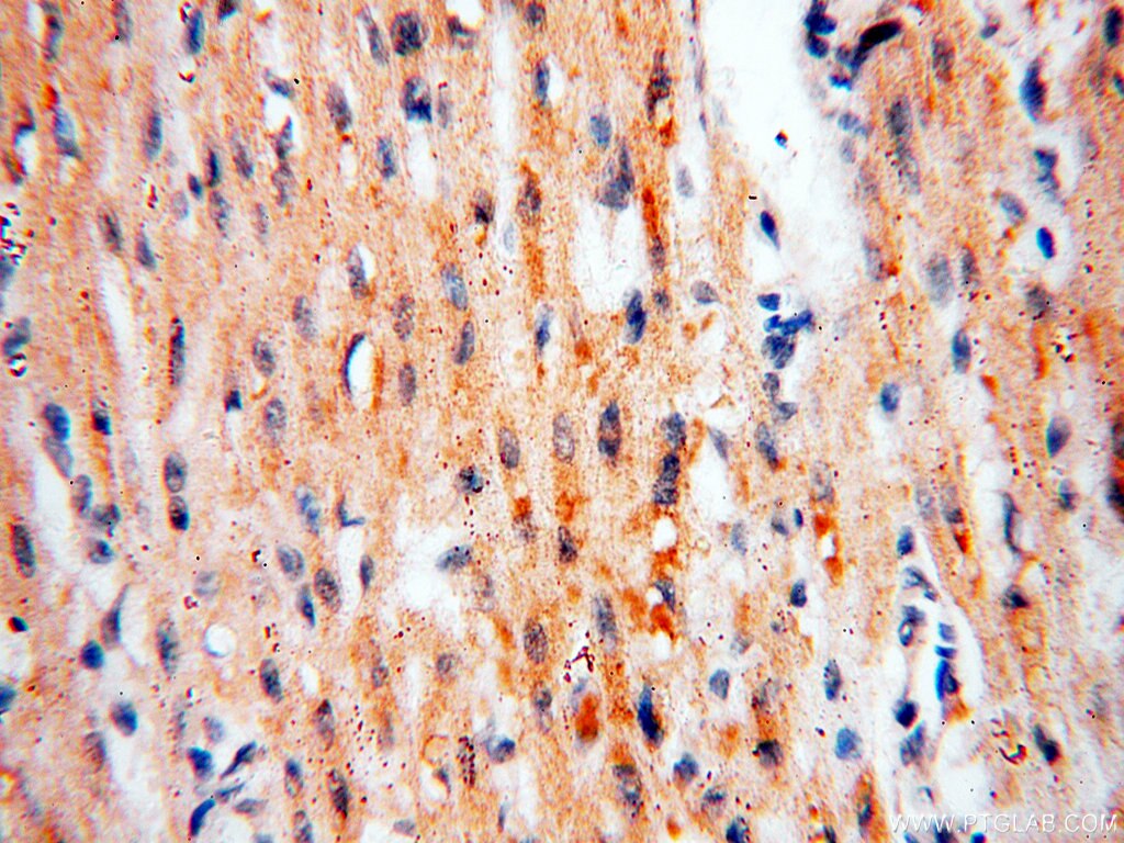 Immunohistochemistry (IHC) staining of human heart tissue using PCSK5 Polyclonal antibody (16470-1-AP)