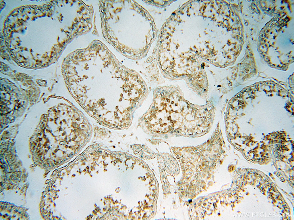 Immunohistochemistry (IHC) staining of human testis tissue using PCSK5 Polyclonal antibody (16470-1-AP)