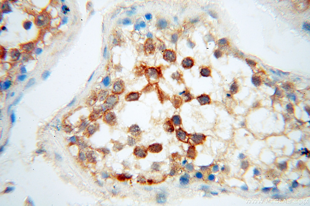 Immunohistochemistry (IHC) staining of human testis tissue using PCSK5 Polyclonal antibody (16470-1-AP)