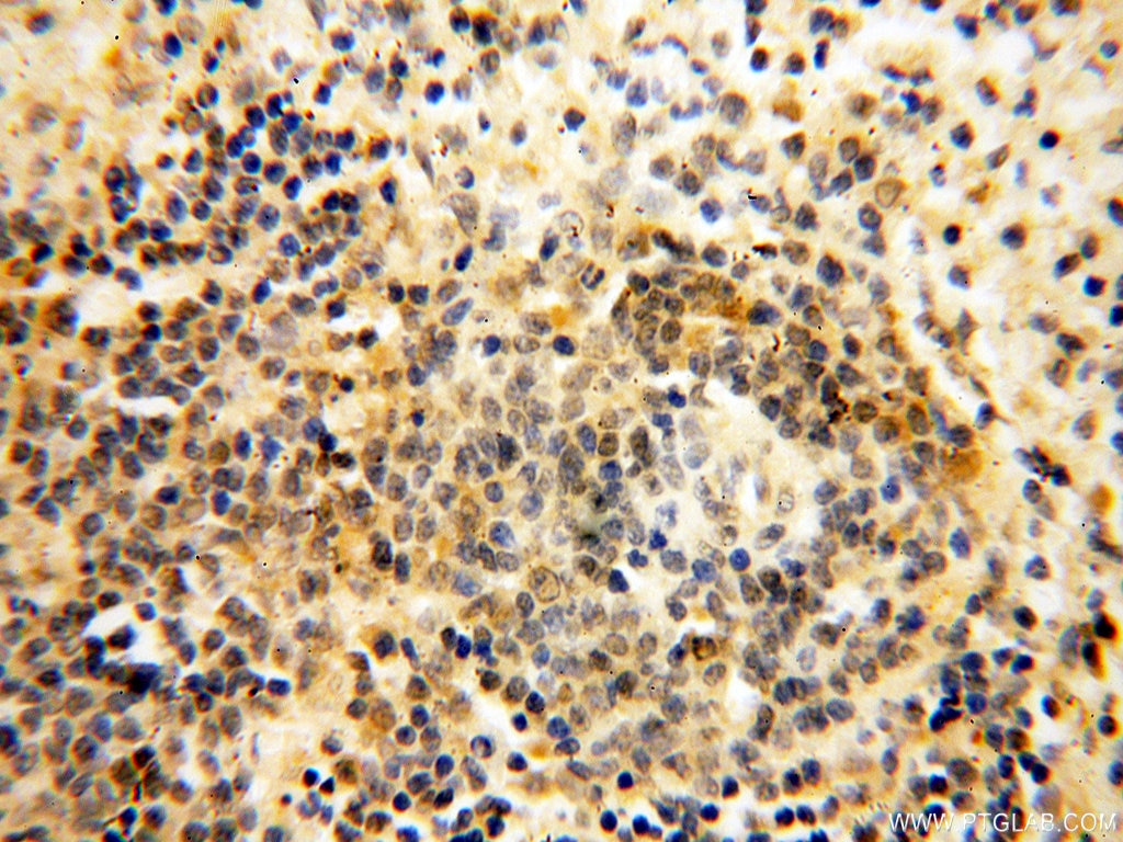 Immunohistochemistry (IHC) staining of human spleen tissue using PCSK5 Polyclonal antibody (16470-1-AP)