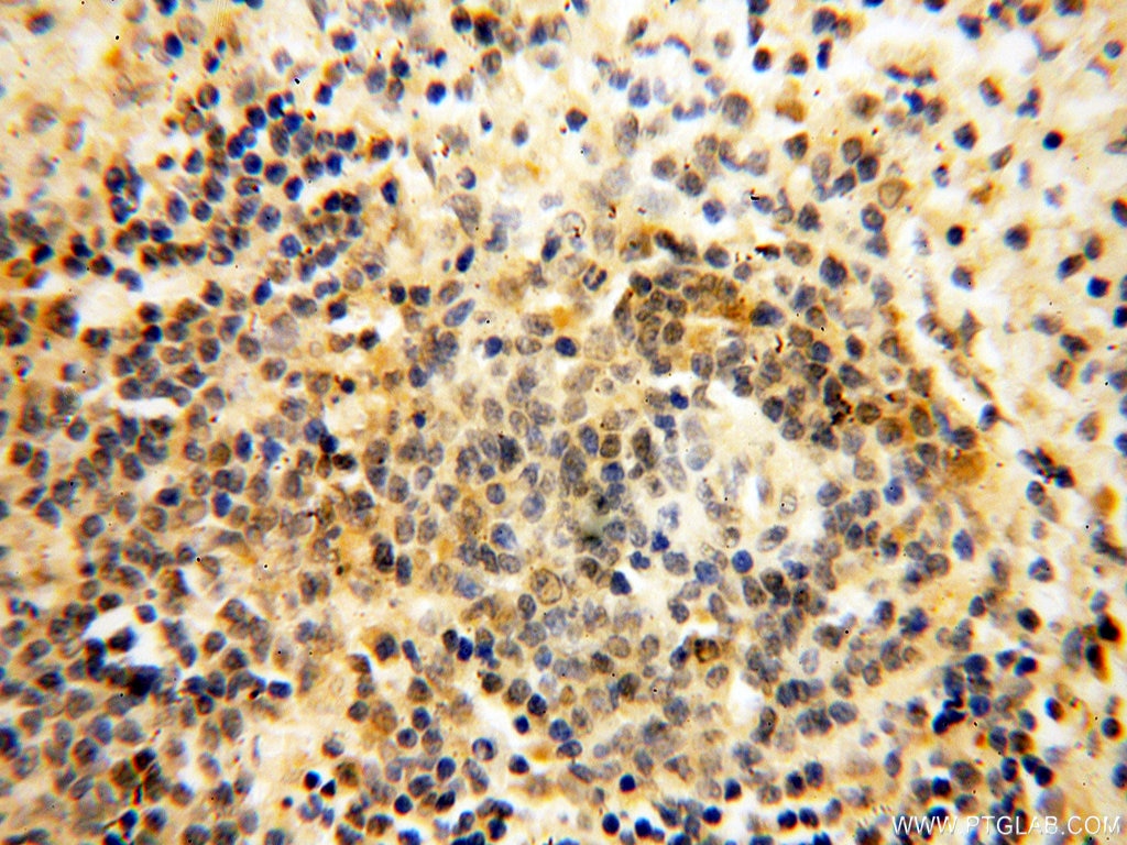 IHC staining of human spleen using 16470-1-AP