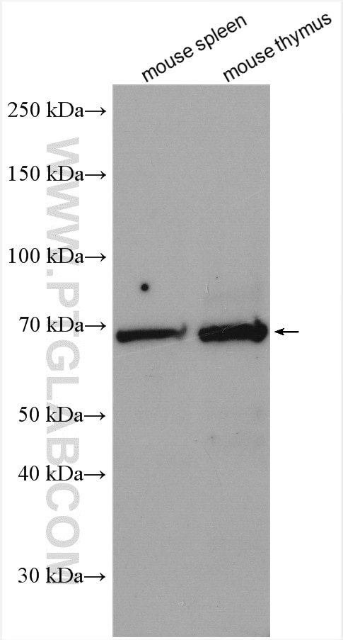 Western Blot (WB) analysis of various lysates using PCSK7 Polyclonal antibody (12044-1-AP)