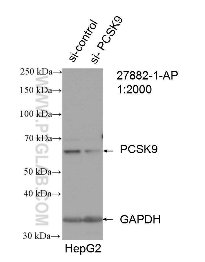 Western Blot (WB) analysis of HepG2 cells using PCSK9 Polyclonal antibody (27882-1-AP)