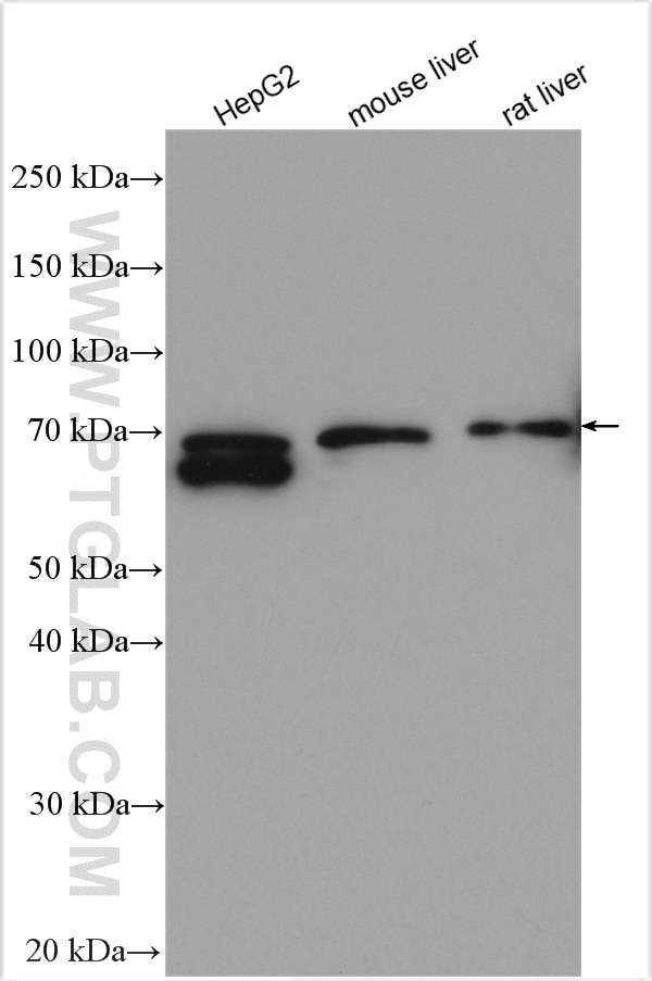 Western Blot (WB) analysis of various lysates using PCSK9 Polyclonal antibody (27882-1-AP)