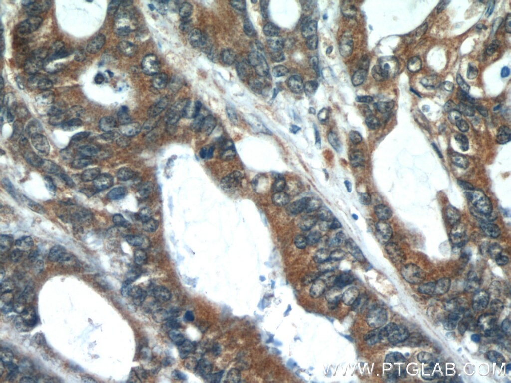 PCSK9 Polyclonal antibody