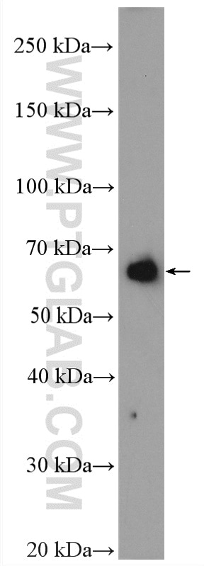 Western Blot (WB) analysis of HepG2 cells using PCSK9 Polyclonal antibody (55206-1-AP)