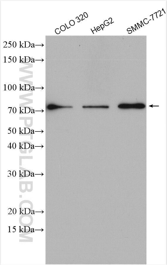 Western Blot (WB) analysis of various lysates using PCSK9 Polyclonal antibody (55206-1-AP)