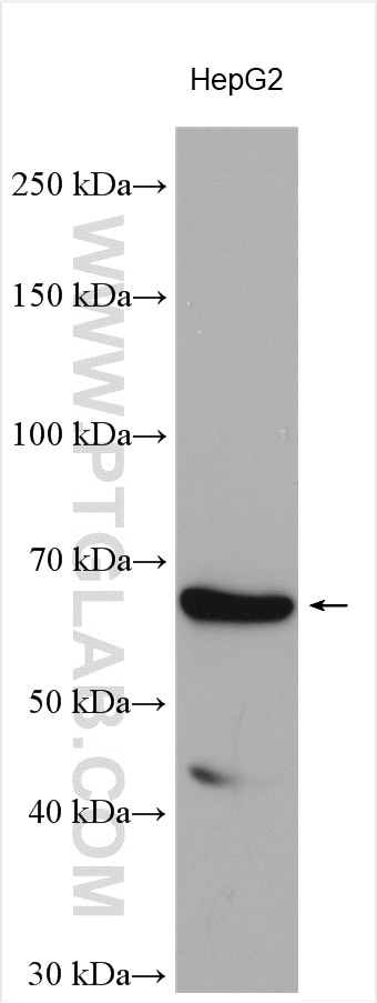 Western Blot (WB) analysis of various lysates using PCSK9 Polyclonal antibody (55206-1-AP)
