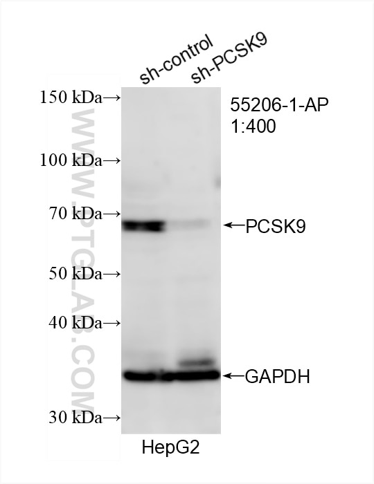 Western Blot (WB) analysis of HepG2 cells using PCSK9 Polyclonal antibody (55206-1-AP)