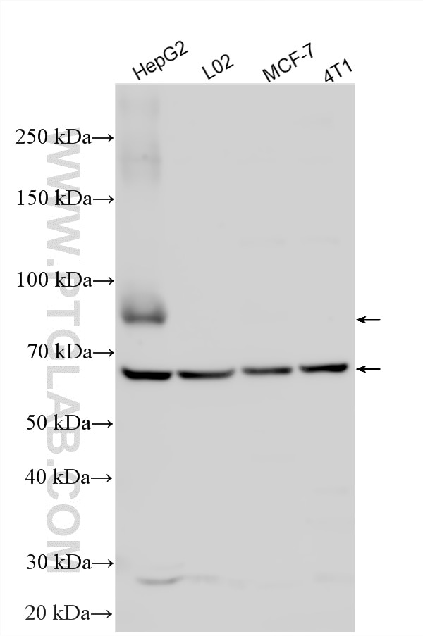 Western Blot (WB) analysis of various lysates using PCSK9 Polyclonal antibody (55206-1-AP)