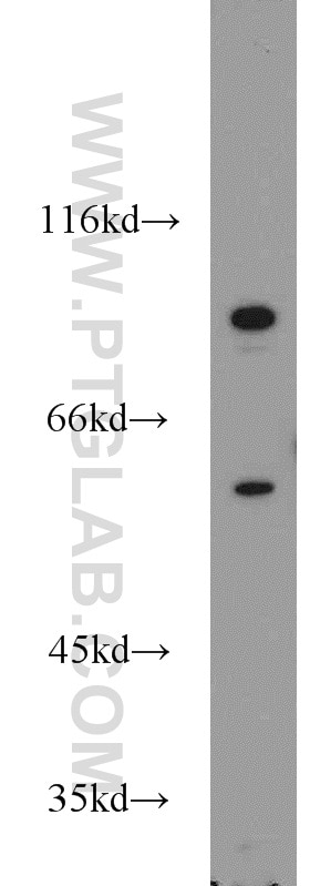 PCSK9 Polyclonal antibody