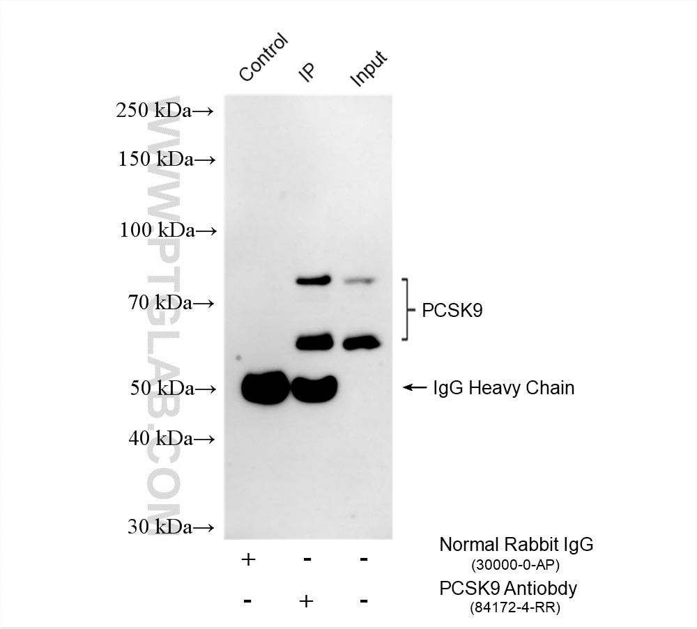 IP experiment of HepG2 using 84172-4-RR (same clone as 84172-4-PBS) Immunoprecipitation (IP) experiment of HepG2 cells using PCSK9 Recombinant monoclonal antibody (84172-4-RR)