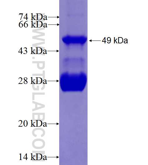 PCSK9 fusion protein Ag27254 SDS-PAGE