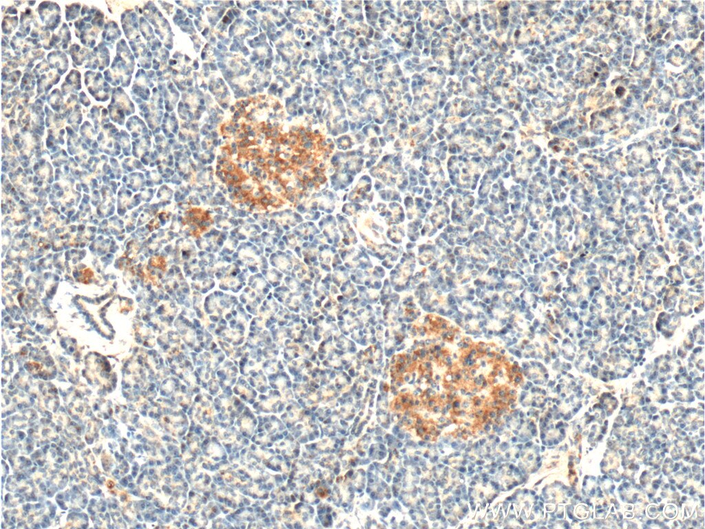 IHC staining of human pancreas using 10102-1-AP