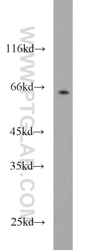 Western Blot (WB) analysis of mouse brain tissue using PCTAIRE1 Polyclonal antibody (10102-1-AP)