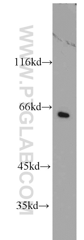 Western Blot (WB) analysis of mouse brain tissue using PCTAIRE1 Polyclonal antibody (10102-1-AP)