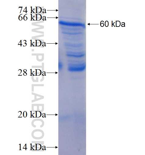 PCTK1 fusion protein Ag0151 SDS-PAGE