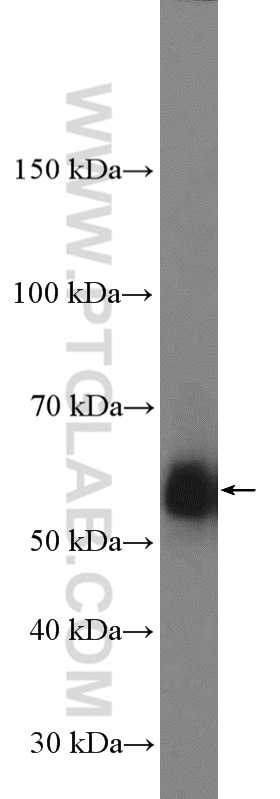 Western Blot (WB) analysis of mouse brain tissue using PCTAIRE3 Polyclonal antibody (12207-1-AP)