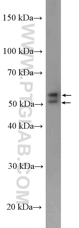 Western Blot (WB) analysis of HEK-293 cells using PCTAIRE3 Polyclonal antibody (12207-1-AP)