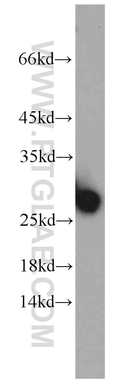 Western Blot (WB) analysis of human kidney tissue using PCTP Polyclonal antibody (11167-1-AP)