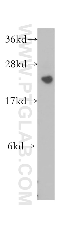Western Blot (WB) analysis of human kidney tissue using PCTP Polyclonal antibody (11167-1-AP)