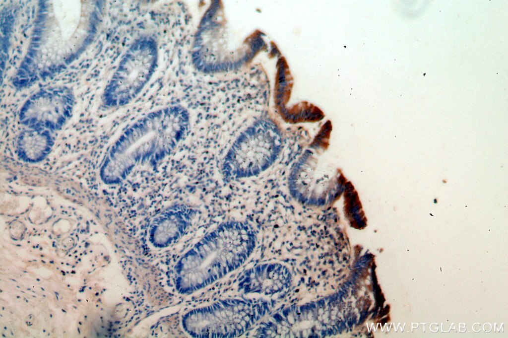 Immunohistochemistry (IHC) staining of human colon tissue using PCYOX1 Polyclonal antibody (18868-1-AP)