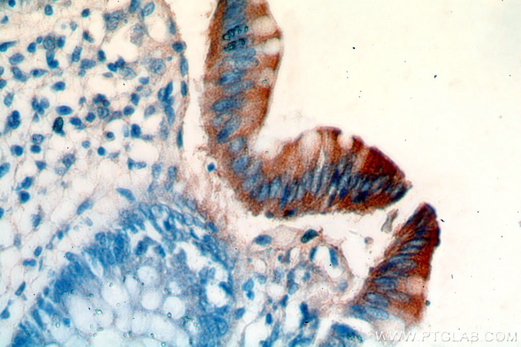 Immunohistochemistry (IHC) staining of human colon tissue using PCYOX1 Polyclonal antibody (18868-1-AP)