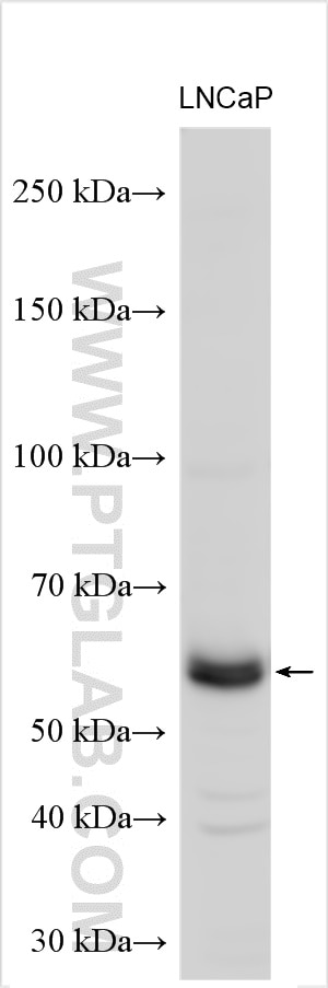 Western Blot (WB) analysis of LNCaP cells using PCYOX1L Polyclonal antibody (30485-1-AP)