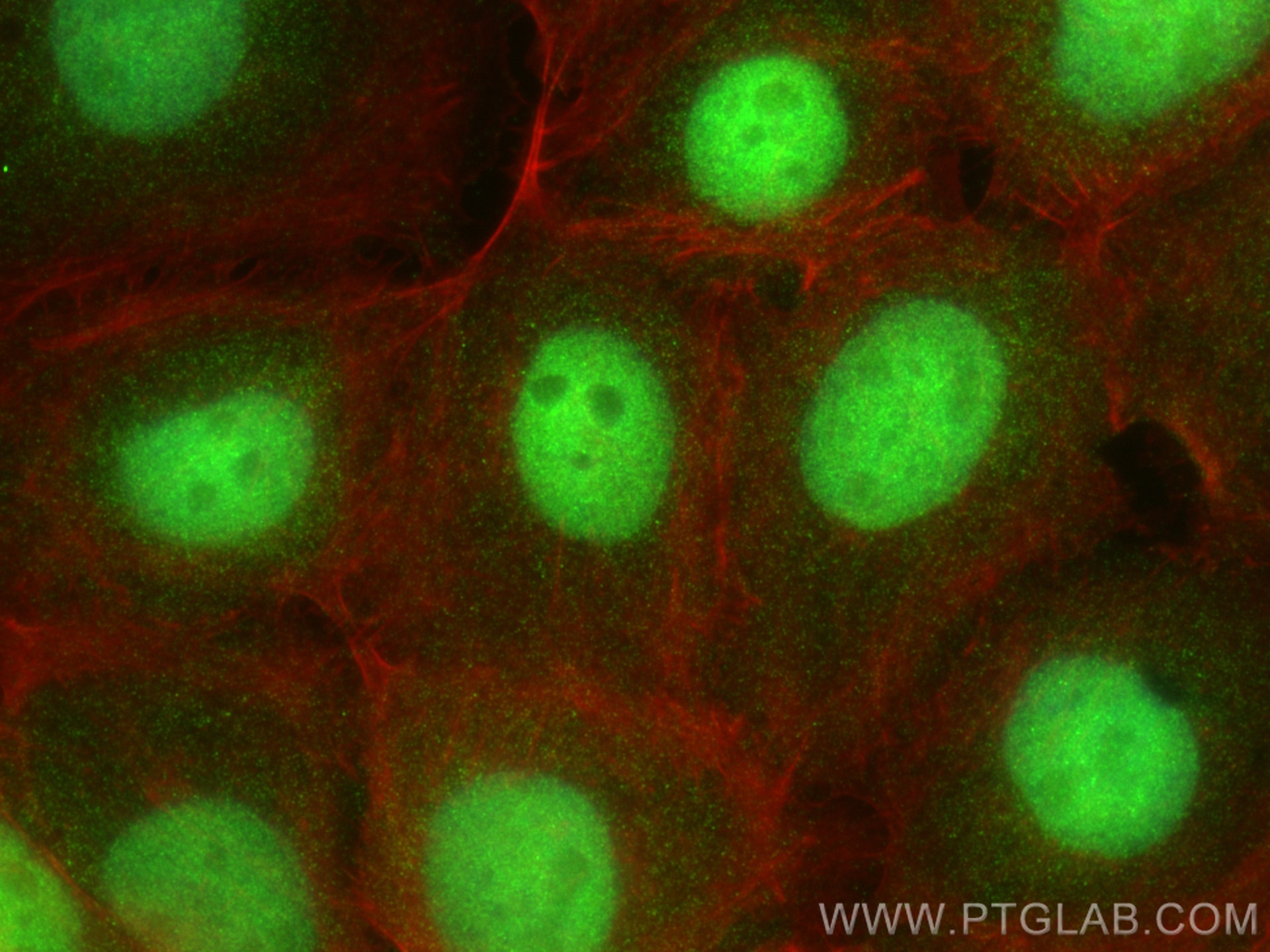 Immunofluorescence (IF) / fluorescent staining of A431 cells using PCYT1A Polyclonal antibody (30991-1-AP)