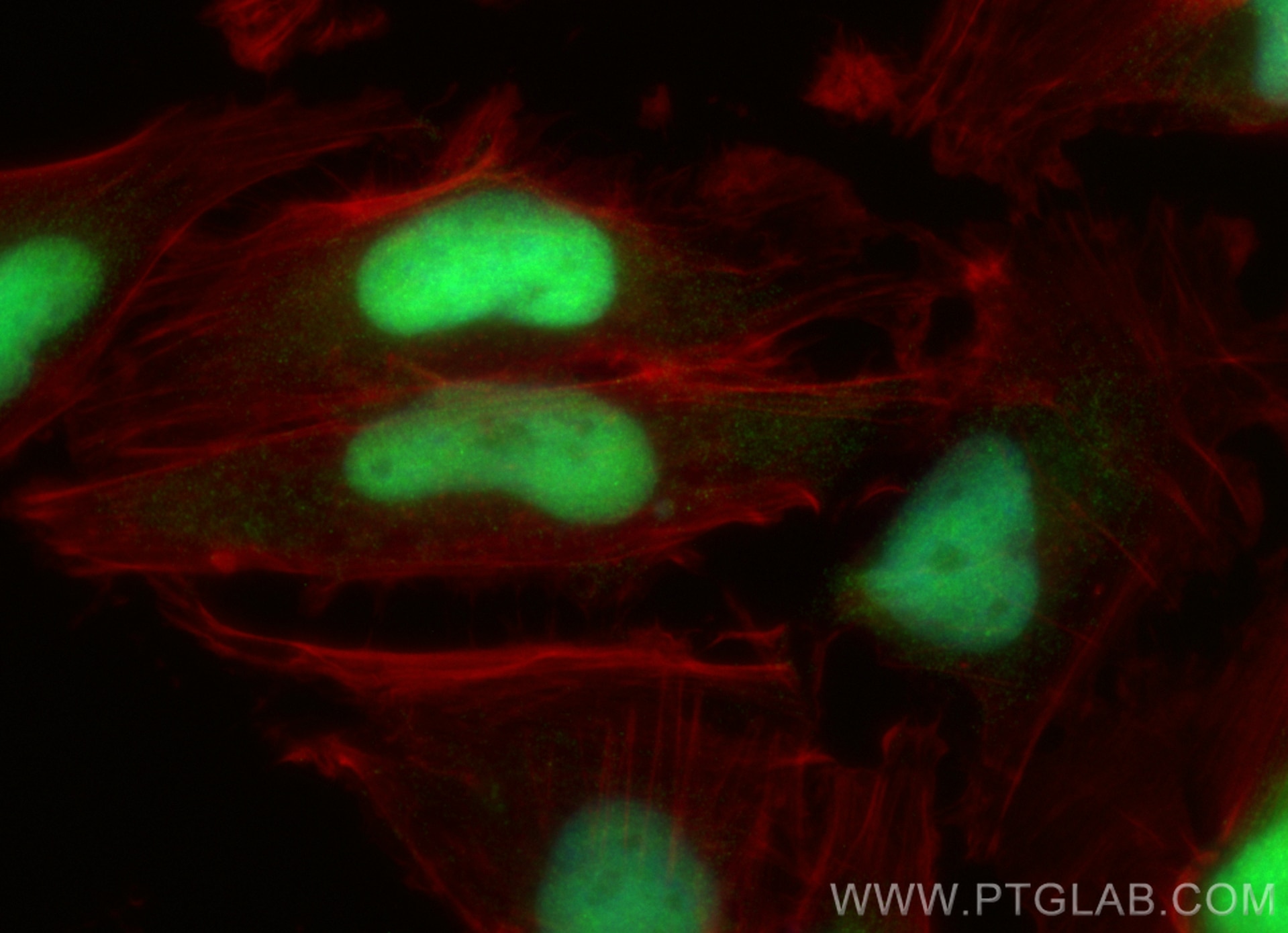 Immunofluorescence (IF) / fluorescent staining of U-251 cells using PCYT1A Polyclonal antibody (30991-1-AP)