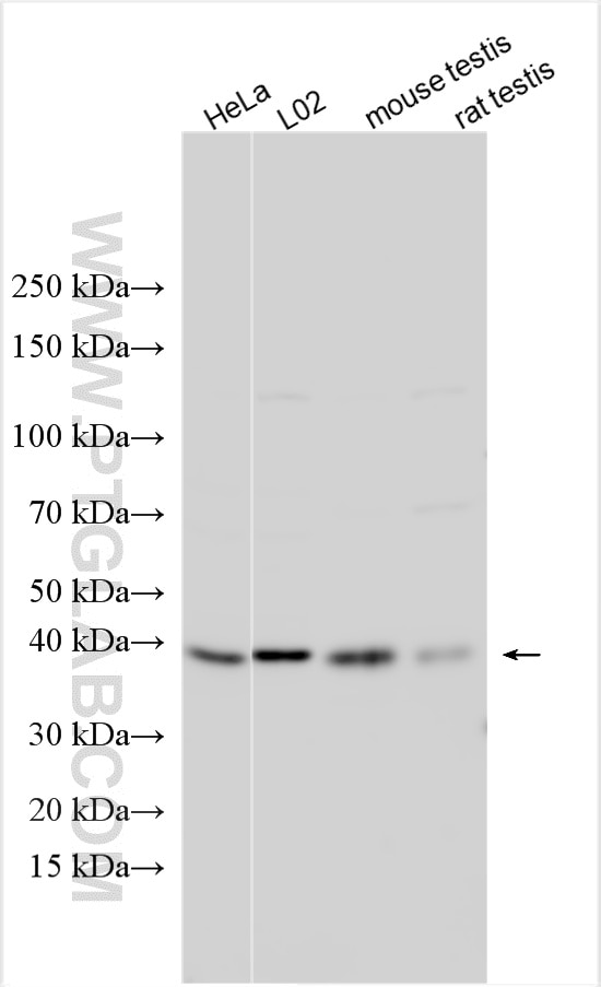 PCYT1A