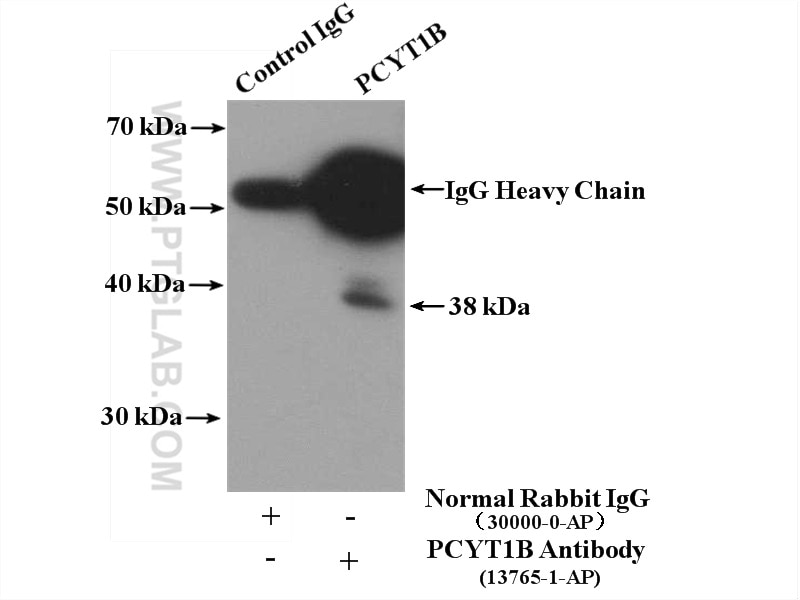 Immunoprecipitation (IP) experiment of human placenta tissue using PCYT1B Polyclonal antibody (13765-1-AP)