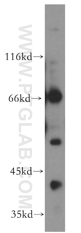 Western Blot (WB) analysis of human placenta tissue using PCYT1B Polyclonal antibody (13765-1-AP)