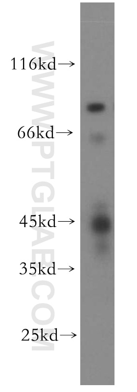 Western Blot (WB) analysis of human brain tissue using PCYT1B Polyclonal antibody (13765-1-AP)