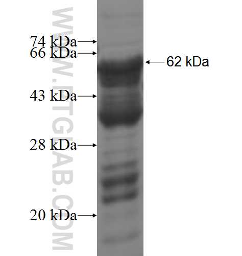 PCYT1B fusion protein Ag4748 SDS-PAGE
