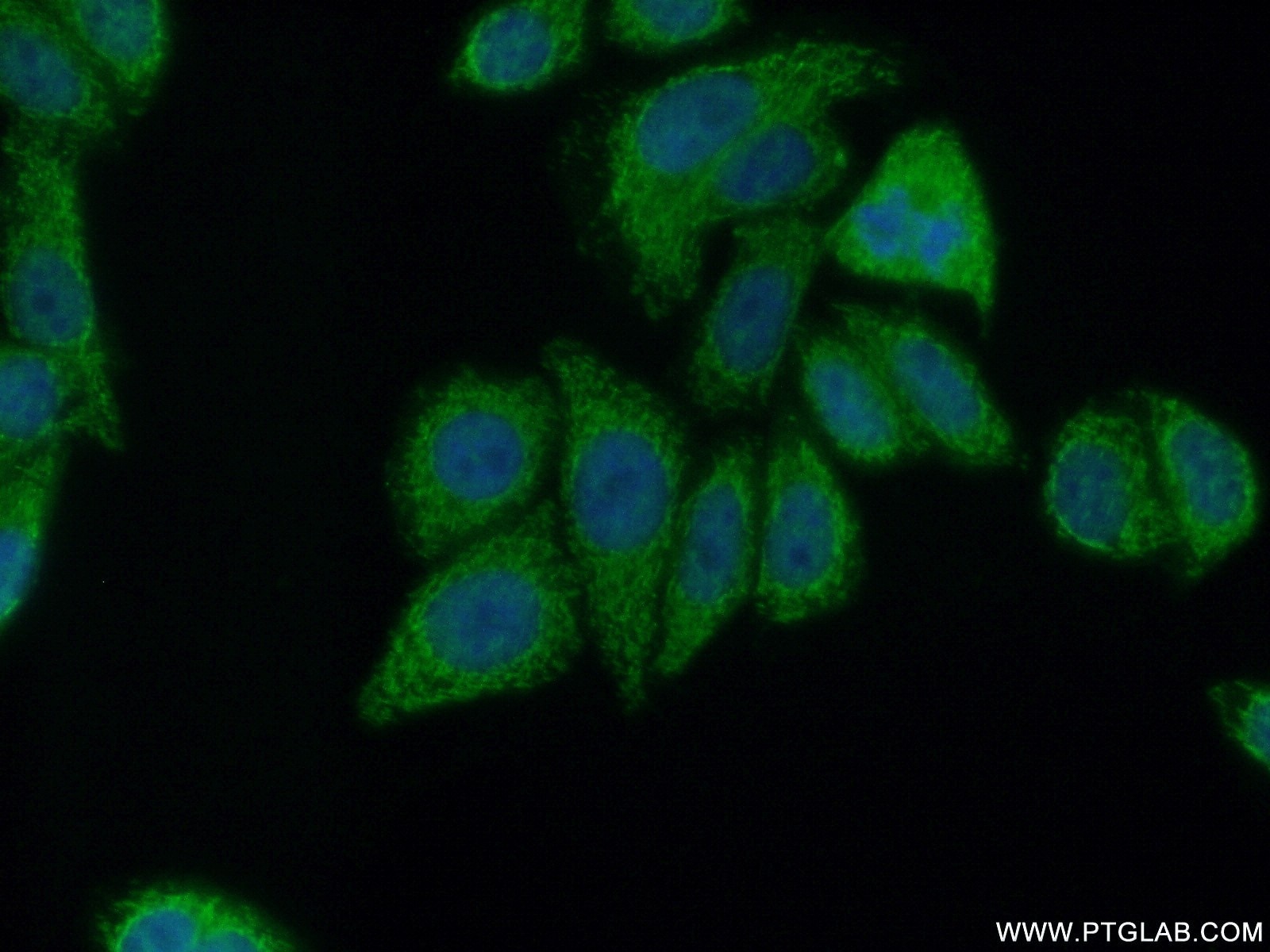 Immunofluorescence (IF) / fluorescent staining of HepG2 cells using PCYT2 Polyclonal antibody (14827-1-AP)