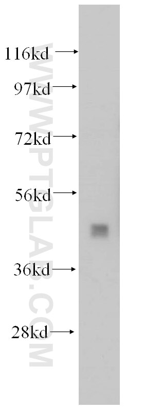 Western Blot (WB) analysis of mouse testis tissue using PCYT2 Polyclonal antibody (14827-1-AP)