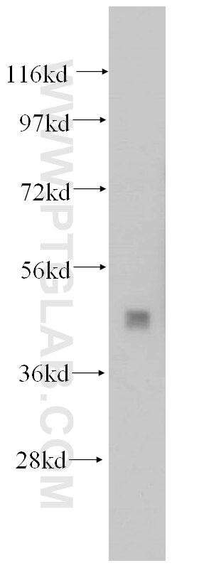 WB analysis of mouse testis using 14827-1-AP