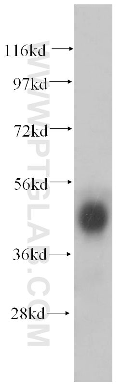Western Blot (WB) analysis of MCF-7 cells using PCYT2 Polyclonal antibody (14827-1-AP)