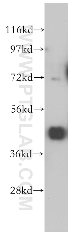 Western Blot (WB) analysis of HepG2 cells using PCYT2 Polyclonal antibody (14827-1-AP)