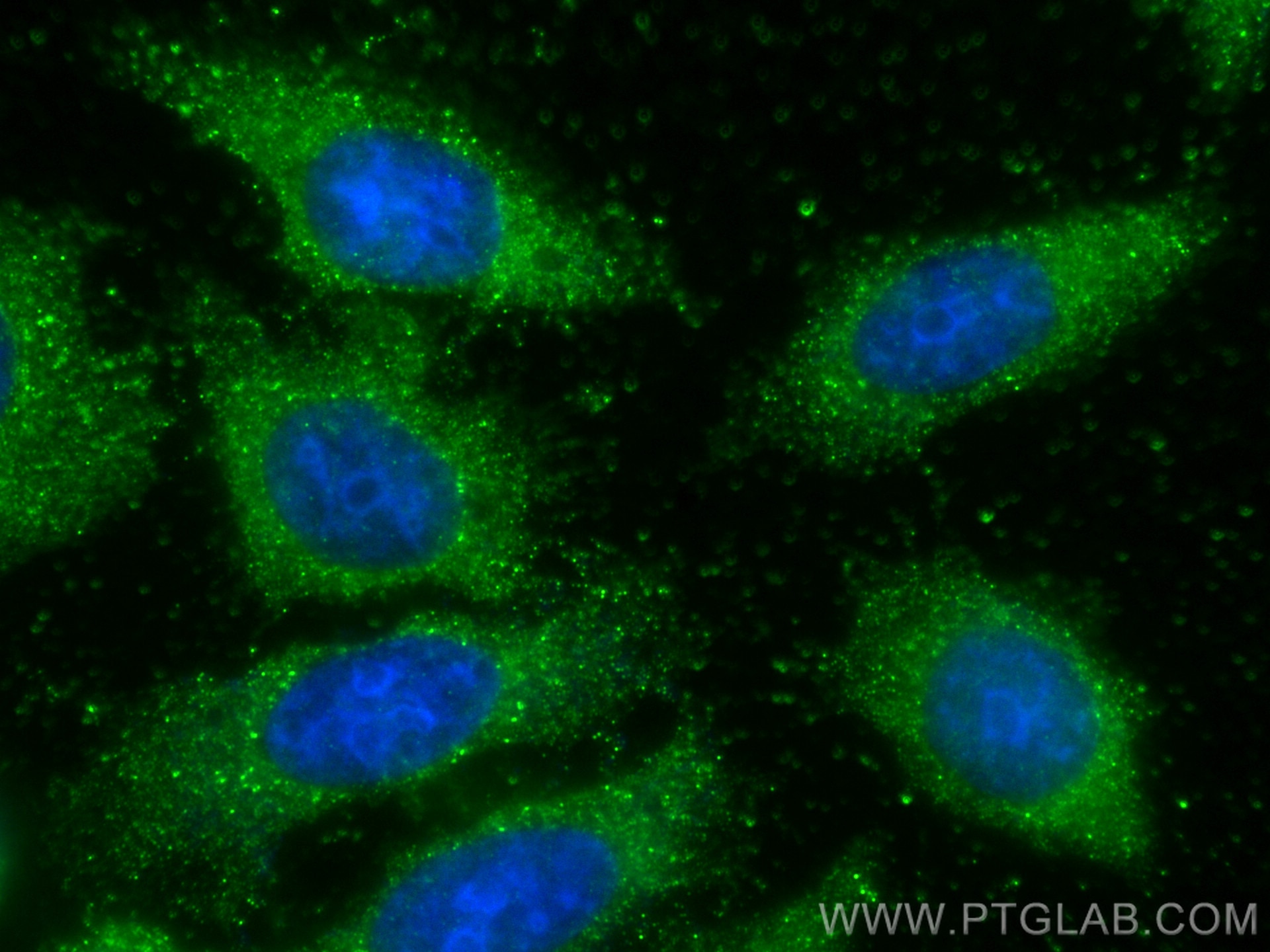 Immunofluorescence (IF) / fluorescent staining of HepG2 cells using PCYT2 Monoclonal antibody (68355-1-Ig)