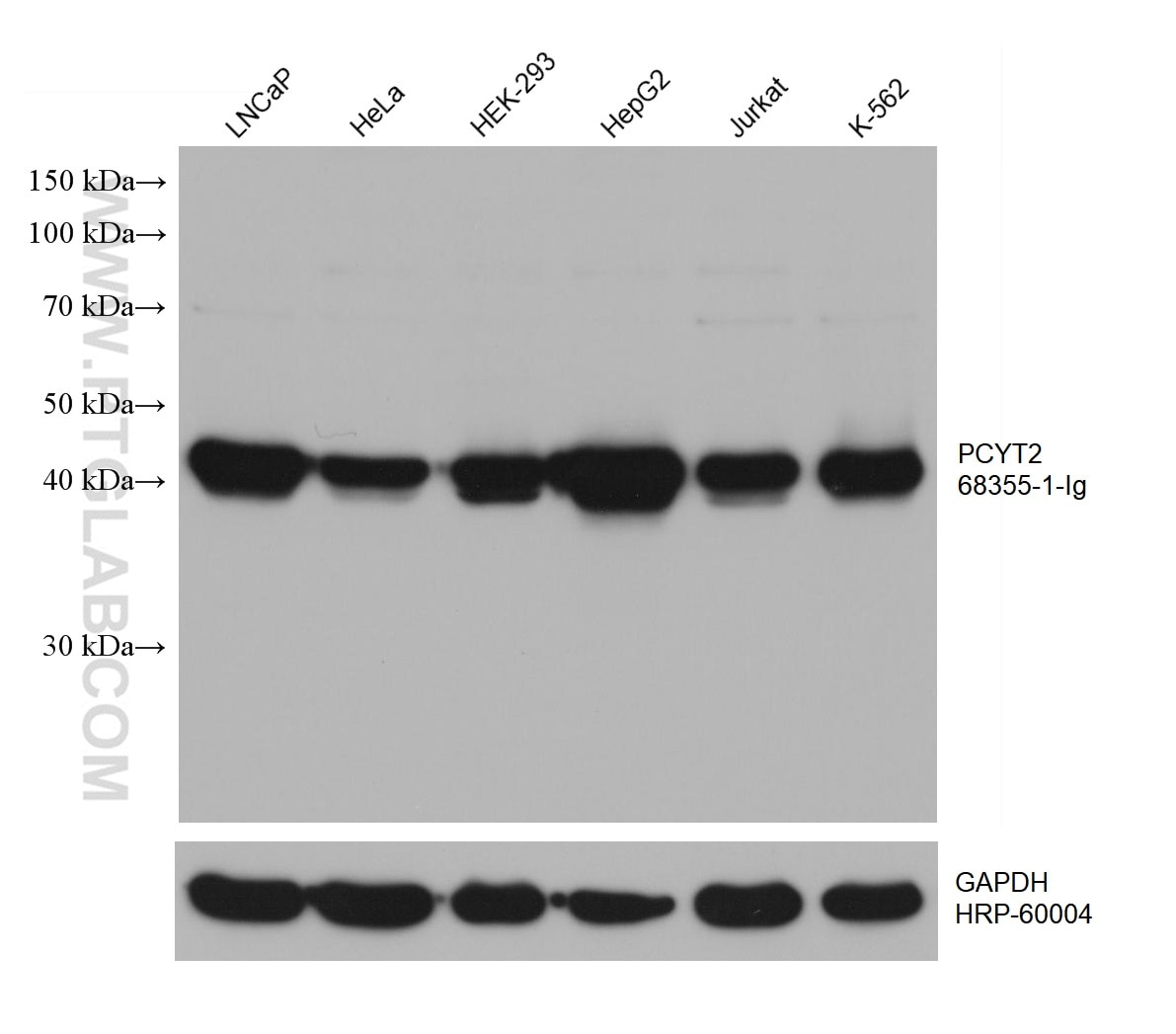 Western Blot (WB) analysis of various lysates using PCYT2 Monoclonal antibody (68355-1-Ig)