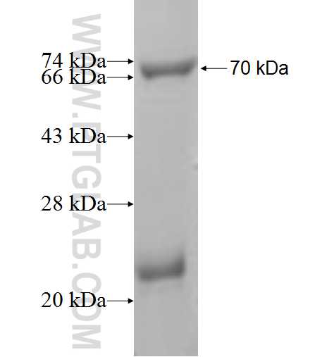 PCYT2 fusion protein Ag6616 SDS-PAGE