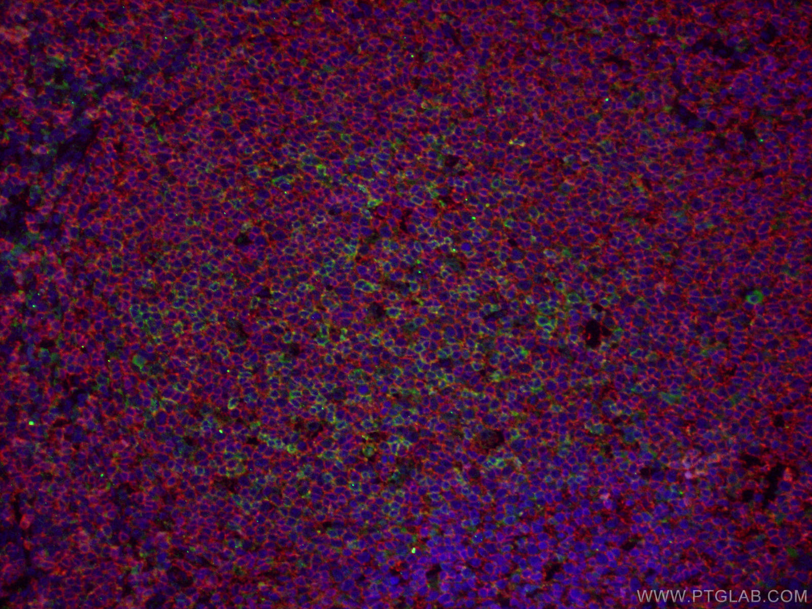 Immunofluorescence (IF) / fluorescent staining of human tonsillitis tissue using PD-1/CD279 Monoclonal antibody (66220-1-Ig)