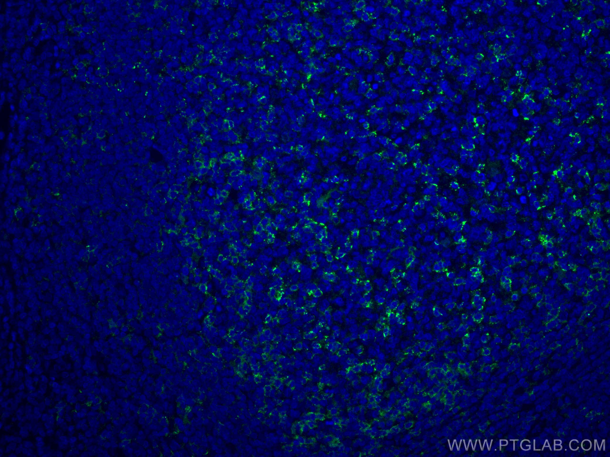 Immunofluorescence (IF) / fluorescent staining of human tonsillitis tissue using PD-1/CD279 Monoclonal antibody (66220-1-Ig)