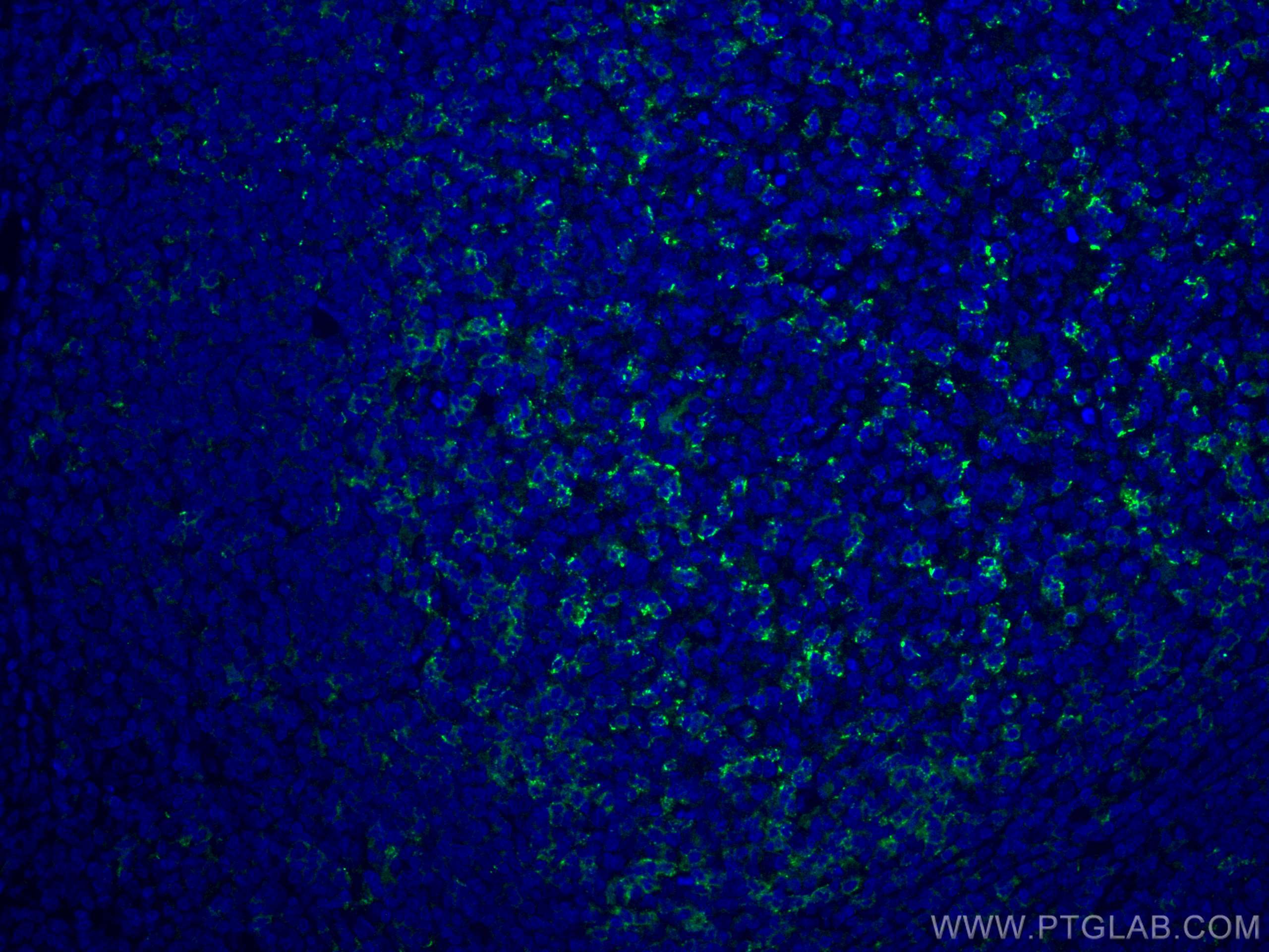 Immunofluorescence (IF) / fluorescent staining of human tonsillitis tissue using PD-1/CD279 Monoclonal antibody (66220-1-Ig)
