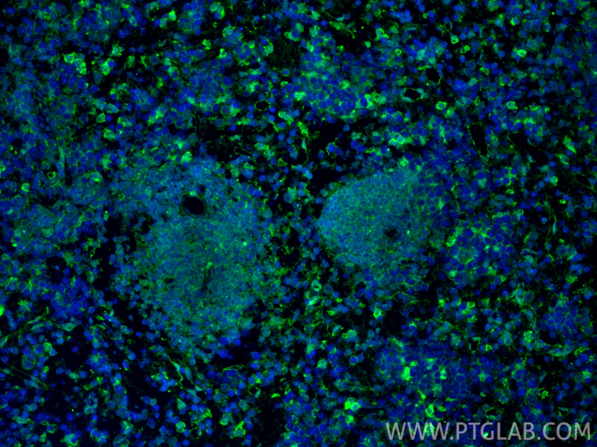 Immunofluorescence (IF) / fluorescent staining of mouse spleen tissue using PD-1/CD279 Monoclonal antibody (66220-1-Ig)