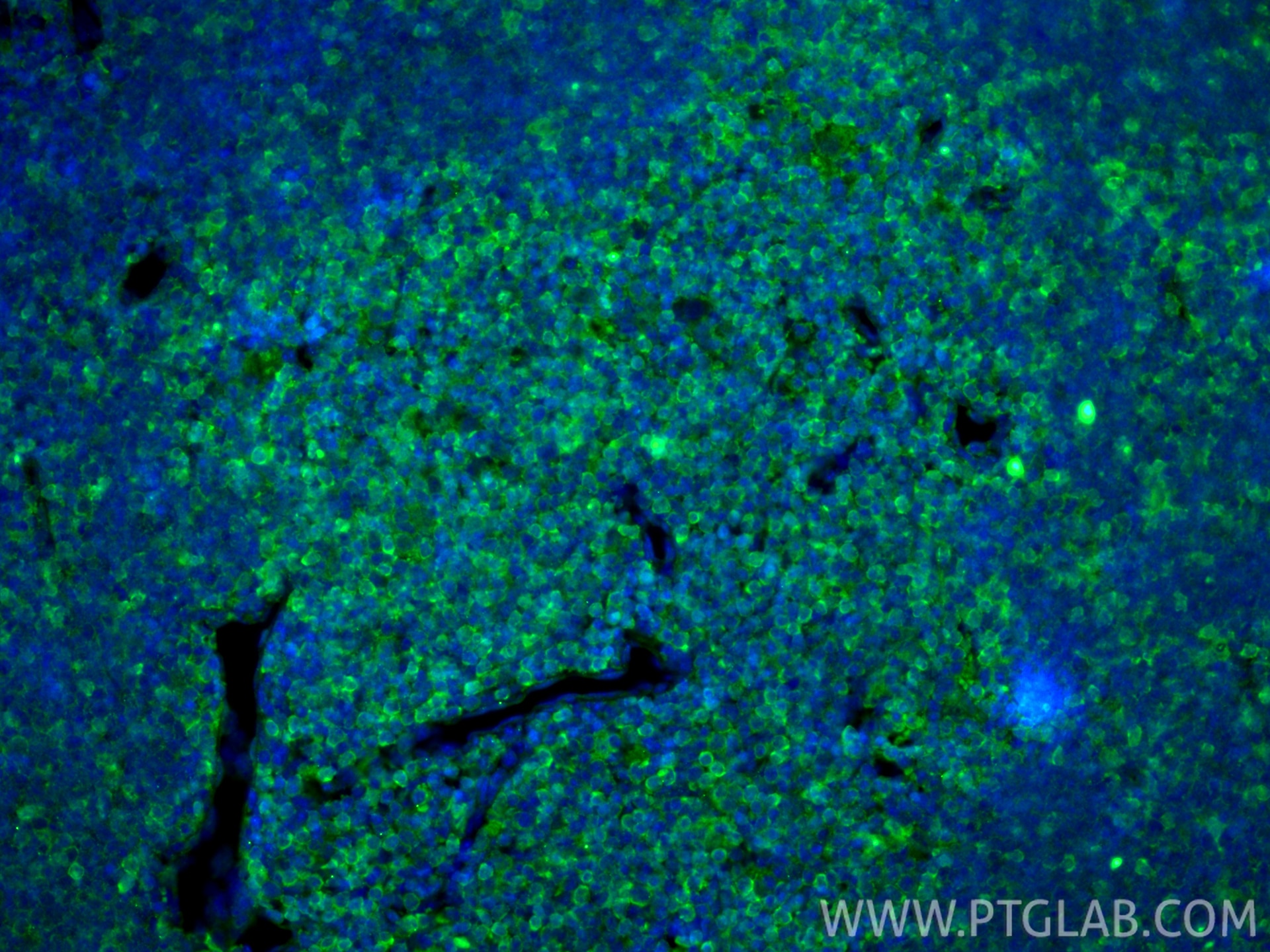 Immunofluorescence (IF) / fluorescent staining of mouse thymus tissue using PD-1/CD279 Monoclonal antibody (66220-1-Ig)