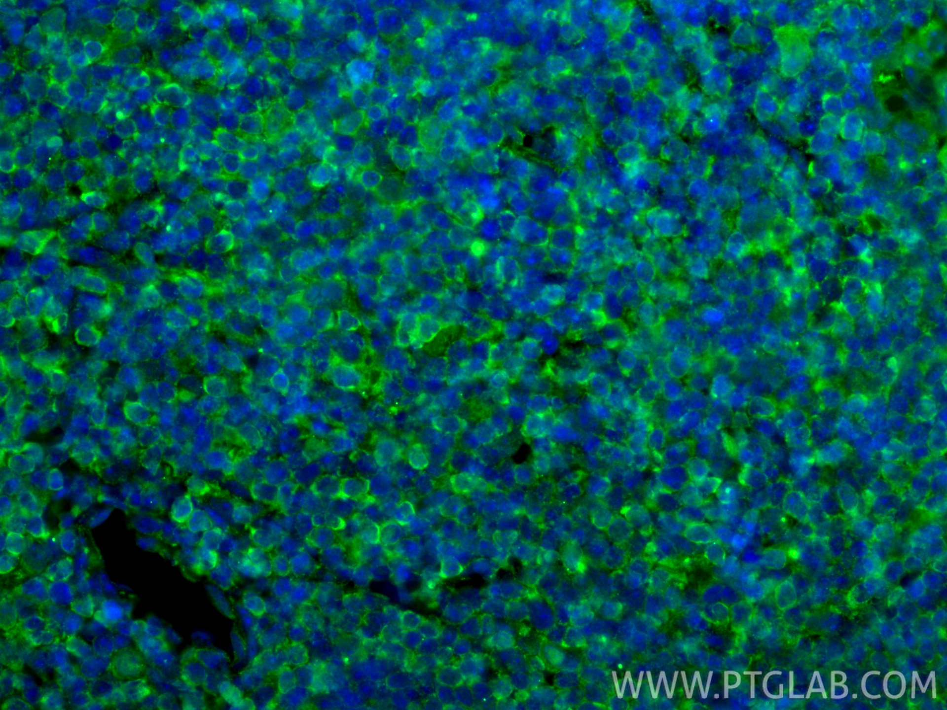 Immunofluorescence (IF) / fluorescent staining of mouse thymus tissue using PD-1/CD279 Monoclonal antibody (66220-1-Ig)